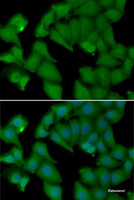 Immunofluorescence analysis of MCF7 cells using HBA1 Polyclonal Antibody