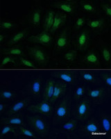 Immunofluorescence analysis of U-2 OS cells using ETS2 Polyclonal Antibody at dilution of 1:100. Blue: DAPI for nuclear staining.