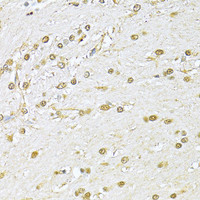 Immunohistochemistry of paraffin-embedded Rat brain using KU70 Polyclonal Antibody at dilution of 1:100 (40x lens) .