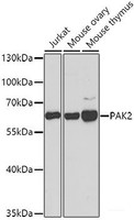 Western blot analysis of extracts of various cell lines using PAK2 Polyclonal Antibody at dilution of 1:1000.