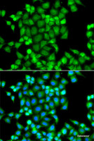 Immunofluorescence analysis of A549 cells using PAK2 Polyclonal Antibody