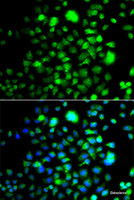 Immunofluorescence analysis of A549 cells using PEX14 Polyclonal Antibody