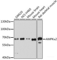 Western blot analysis of extracts of various cell lines using AMPKα2 Polyclonal Antibody at dilution of 1:1000.