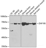 Western blot analysis of extracts of various cell lines using ZNF195 Polyclonal Antibody at dilution of 1:1000.