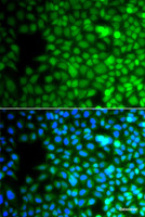 Immunofluorescence analysis of A549 cells using ZNF195 Polyclonal Antibody