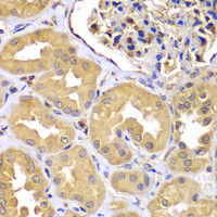 Immunohistochemistry of paraffin-embedded Human kidney using LZTR1 Polyclonal Antibody at dilution of 1:100 (40x lens) .