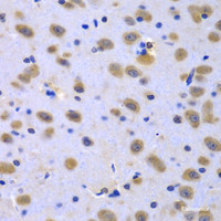 Immunohistochemistry of paraffin-embedded Rat brain using CIAO1 Polyclonal Antibody at dilution of 1:100 (40x lens) .