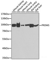Western blot analysis of extracts of various cell lines using PRDM5 Polyclonal Antibody at dilution of 1:1000.