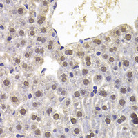 Immunohistochemistry of paraffin-embedded Mouse liver using PRDM5 Polyclonal Antibody at dilution of 1:100 (40x lens) .