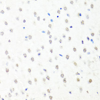 Immunohistochemistry of paraffin-embedded Mouse brain using CHRAC1 Polyclonal Antibody at dilution of 1:100 (40x lens) .