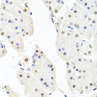 Immunohistochemistry of paraffin-embedded Human stomach using CHRAC1 Polyclonal Antibody at dilution of 1:100 (40x lens) .