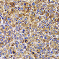 Immunohistochemistry of paraffin-embedded Mouse cancer using UBE2R2 Polyclonal Antibody at dilution of 1:100 (40x lens) .