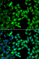 Immunofluorescence analysis of A549 cells using DCP1A Polyclonal Antibody