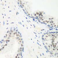 Immunohistochemistry of paraffin-embedded Human prostate using PPAN Polyclonal Antibody at dilution of 1:200 (40x lens) .