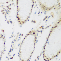 Immunohistochemistry of paraffin-embedded Human stomach using PPAN Polyclonal Antibody at dilution of 1:200 (40x lens) .