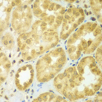 Immunohistochemistry of paraffin-embedded Human kidney using ADCK3 Polyclonal Antibody at dilution of 1:100 (40x lens) .