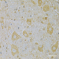 Immunohistochemistry of paraffin-embedded Mouse brain using CAMK1G Polyclonal Antibody at dilution of 1:100 (40x lens) .