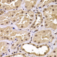 Immunohistochemistry of paraffin-embedded Human kidney using CSRP2BP Polyclonal Antibody at dilution of 1:100 (40x lens) .