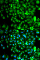 Immunofluorescence analysis of A549 cells using CSRP2BP Polyclonal Antibody