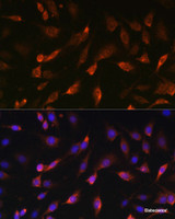 Immunofluorescence analysis of C6 cells using STIM1 Polyclonal Antibody at dilution of 1:100. Blue: DAPI for nuclear staining.