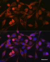 Immunofluorescence analysis of HeLa cells using STIM1 Polyclonal Antibody at dilution of 1:100. Blue: DAPI for nuclear staining.