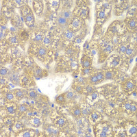 Immunohistochemistry of paraffin-embedded Mouse liver using CYP2C18 Polyclonal Antibody at dilution of 1:100 (40x lens) .
