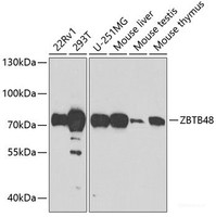 Western blot analysis of extracts of various cell lines using ZBTB48 Polyclonal Antibody at dilution of 1:1000.