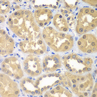 Immunohistochemistry of paraffin-embedded Human kidney using KHK Polyclonal Antibody at dilution of 1:100 (40x lens) .