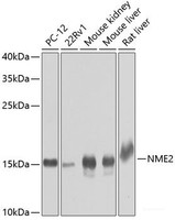 Western blot analysis of extracts of various cell lines using NME2 Polyclonal Antibody at dilution of 1:1000.