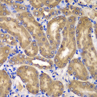 Immunohistochemistry of paraffin-embedded Mouse kidney using NME2 Polyclonal Antibody at dilution of 1:100 (40x lens) .