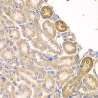 Immunohistochemistry of paraffin-embedded Rat kidney using PIP4K2A Polyclonal Antibody at dilution of 1:100 (40x lens) .