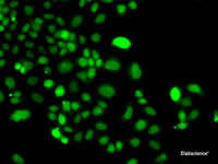 Immunofluorescence analysis of A549 cells using PIP4K2A Polyclonal Antibody