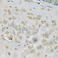 Immunohistochemistry of paraffin-embedded Rat brain using SAR1A Polyclonal Antibody at dilution of 1:100 (40x lens) .