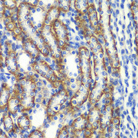Immunohistochemistry of paraffin-embedded Rat kidney using ZFAND3 Polyclonal Antibody at dilution of 1:100 (40x lens) .