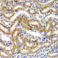 Immunohistochemistry of paraffin-embedded Mouse kidney using ZFAND3 Polyclonal Antibody at dilution of 1:100 (40x lens) .