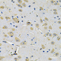 Immunohistochemistry of paraffin-embedded Rat brain using RRAGC Polyclonal Antibody at dilution of 1:100 (40x lens) .