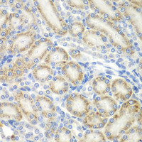 Immunohistochemistry of paraffin-embedded Rat kidney using ASPSCR1 Polyclonal Antibody at dilution of 1:100 (40x lens) .