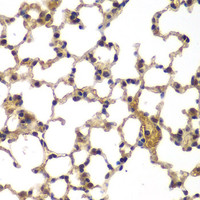 Immunohistochemistry of paraffin-embedded Mouse lung using ASPSCR1 Polyclonal Antibody at dilution of 1:100 (40x lens) .