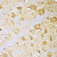 Immunohistochemistry of paraffin-embedded Mouse brain using SPAG16 Polyclonal Antibody at dilution of 1:100 (40x lens) .