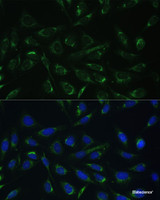Immunofluorescence analysis of U-2 OS cells using HCCS Polyclonal Antibody at dilution of 1:100 (40x lens) . Blue: DAPI for nuclear staining.