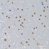 Immunohistochemistry of paraffin-embedded Rat spinal cord using HNRNPA1 Polyclonal Antibody at dilution of 1:100 (40x lens) .