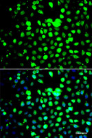 Immunofluorescence analysis of A549 cells using ZBTB25 Polyclonal Antibody