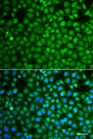 Immunofluorescence analysis of A549 cells using ZNF346 Polyclonal Antibody