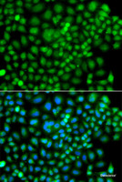 Immunofluorescence analysis of A549 cells using SUMO4 Polyclonal Antibody