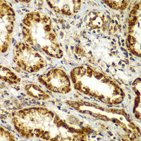 Immunohistochemistry of paraffin-embedded Human kidney using SMAD9 Polyclonal Antibody at dilution of 1:100 (40x lens) .