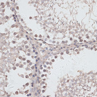 Immunohistochemistry of paraffin-embedded Rat testis using ATG14 Polyclonal Antibody at dilution of 1:100 (40x lens) .