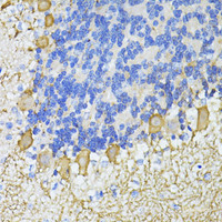 Immunohistochemistry of paraffin-embedded Mouse cerebellum using CA8 Polyclonal Antibody at dilution of 1:100 (40x lens) .