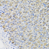 Immunohistochemistry of paraffin-embedded Mouse stomach using CBR3 Polyclonal Antibody at dilution of 1:100 (40x lens) .