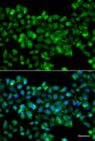 Immunofluorescence analysis of A549 cells using CBR3 Polyclonal Antibody