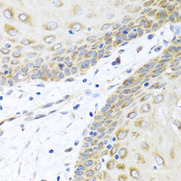 Immunohistochemistry of paraffin-embedded Human esophagus using INHBC Polyclonal Antibody at dilution of 1:100 (40x lens) .